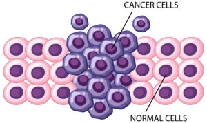 Exploring OncoCount and Its Significance in Cancer Diagnosis